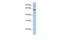 RFT1 Homolog antibody, GTX45900, GeneTex, Western Blot image 