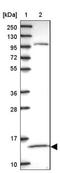 Yippee Like 5 antibody, NBP2-13530, Novus Biologicals, Western Blot image 