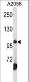 Adaptor Related Protein Complex 2 Subunit Beta 1 antibody, LS-C156388, Lifespan Biosciences, Western Blot image 