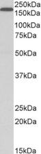 LDL Receptor Related Protein 5 antibody, NB100-1886, Novus Biologicals, Western Blot image 