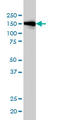 Phosphatidylinositol-3,4,5-trisphosphate 5-phosphatase 2 antibody, LS-C197540, Lifespan Biosciences, Western Blot image 