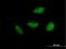 Nucleolar Protein 6 antibody, H00065083-B01P, Novus Biologicals, Immunofluorescence image 