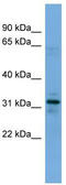 Myozenin 1 antibody, TA346636, Origene, Western Blot image 