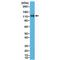 Catenin Delta 1 antibody, M02333-1, Boster Biological Technology, Western Blot image 