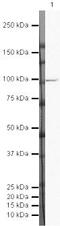 DAB Adaptor Protein 2 antibody, PA5-19615, Invitrogen Antibodies, Western Blot image 