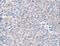 Receptor Tyrosine Kinase Like Orphan Receptor 1 antibody, LS-B15816, Lifespan Biosciences, Immunohistochemistry frozen image 