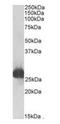 Glutathione S-transferase alpha-3 antibody, orb22559, Biorbyt, Western Blot image 