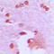 Amyloid Beta Precursor Protein Binding Family A Member 2 antibody, LS-C353891, Lifespan Biosciences, Immunohistochemistry paraffin image 