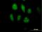 Mixed Lineage Kinase Domain Like Pseudokinase antibody, H00197259-B01P, Novus Biologicals, Immunofluorescence image 