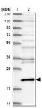 Centrin 3 antibody, NBP1-84547, Novus Biologicals, Western Blot image 