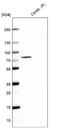 Ankyrin Repeat And Sterile Alpha Motif Domain Containing 6 antibody, NBP1-89081, Novus Biologicals, Western Blot image 