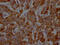 S100 Calcium Binding Protein A9 antibody, CSB-RA958800A0HU, Cusabio, Immunohistochemistry paraffin image 