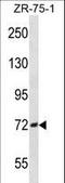 Sodium Channel Epithelial 1 Beta Subunit antibody, LS-B9624, Lifespan Biosciences, Western Blot image 