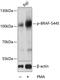 B-Raf Proto-Oncogene, Serine/Threonine Kinase antibody, A00075S445, Boster Biological Technology, Western Blot image 