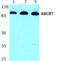 ATP Binding Cassette Subfamily B Member 7 antibody, A06088-1, Boster Biological Technology, Western Blot image 