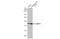 Heterogeneous Nuclear Ribonucleoprotein F antibody, GTX114476, GeneTex, Western Blot image 