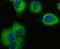 Vinculin antibody, NBP2-75708, Novus Biologicals, Immunofluorescence image 