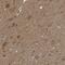 Protein Tyrosine Phosphatase Receptor Type T antibody, NBP1-81524, Novus Biologicals, Immunohistochemistry frozen image 