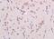 Ring Finger Protein 123 antibody, orb2733, Biorbyt, Immunohistochemistry paraffin image 