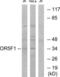 Olfactory Receptor Family 5 Subfamily F Member 1 antibody, LS-C120889, Lifespan Biosciences, Western Blot image 