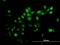 Tripartite Motif Containing 39 antibody, H00056658-B02P, Novus Biologicals, Immunocytochemistry image 