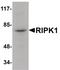 Receptor Interacting Serine/Threonine Kinase 1 antibody, PA5-20811, Invitrogen Antibodies, Western Blot image 