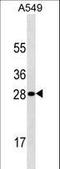 Hypoxanthine Phosphoribosyltransferase 1 antibody, LS-C159869, Lifespan Biosciences, Western Blot image 