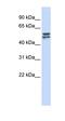 Glucose-6-Phosphate Dehydrogenase antibody, orb330977, Biorbyt, Western Blot image 