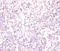 Tachykinin Receptor 1 antibody, LS-C211289, Lifespan Biosciences, Immunohistochemistry paraffin image 