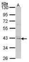 Death Associated Protein Kinase 2 antibody, PA5-34704, Invitrogen Antibodies, Western Blot image 