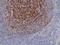 Complement C3d Receptor 2 antibody, M01632-1, Boster Biological Technology, Immunohistochemistry paraffin image 