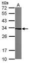 Tubulin-folding cofactor B antibody, GTX101940, GeneTex, Western Blot image 