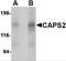 Calcium Dependent Secretion Activator 2 antibody, 4565, ProSci Inc, Western Blot image 
