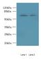 TBC1 Domain Family Member 19 antibody, A61234-100, Epigentek, Western Blot image 