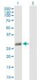 Testis Expressed 101 antibody, H00083639-B01P, Novus Biologicals, Western Blot image 