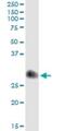 TIMP Metallopeptidase Inhibitor 1 antibody, H00007076-M01, Novus Biologicals, Immunoprecipitation image 