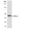 C-C Motif Chemokine Receptor Like 2 antibody, LS-C291763, Lifespan Biosciences, Western Blot image 