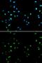 Histone Deacetylase 4 antibody, GTX32646, GeneTex, Immunocytochemistry image 