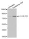 Component Of Inhibitor Of Nuclear Factor Kappa B Kinase Complex antibody, abx000225, Abbexa, Western Blot image 