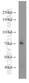 Transcription Factor 7 Like 2 antibody, 13838-1-AP, Proteintech Group, Western Blot image 