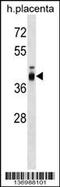 Zona Pellucida Glycoprotein 3 antibody, 59-051, ProSci, Western Blot image 