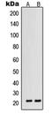 Vascular Endothelial Growth Factor B antibody, LS-C352985, Lifespan Biosciences, Western Blot image 