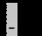 Transgelin 2 antibody, 203306-T32, Sino Biological, Western Blot image 