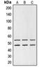 Glycogen Synthase Kinase 3 Alpha antibody, orb214019, Biorbyt, Western Blot image 