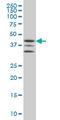 MAPK Activated Protein Kinase 2 antibody, LS-C133109, Lifespan Biosciences, Western Blot image 