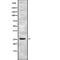 CD81 Molecule antibody, abx146734, Abbexa, Western Blot image 