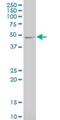 Calcium/Calmodulin Dependent Protein Kinase II Alpha antibody, H00000815-M01, Novus Biologicals, Western Blot image 