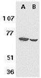 Fem-1 Homolog B antibody, GTX23686, GeneTex, Western Blot image 