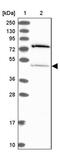 THUMP Domain Containing 2 antibody, PA5-60211, Invitrogen Antibodies, Western Blot image 