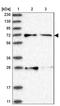 Acyl-CoA Oxidase 3, Pristanoyl antibody, NBP1-85901, Novus Biologicals, Western Blot image 
